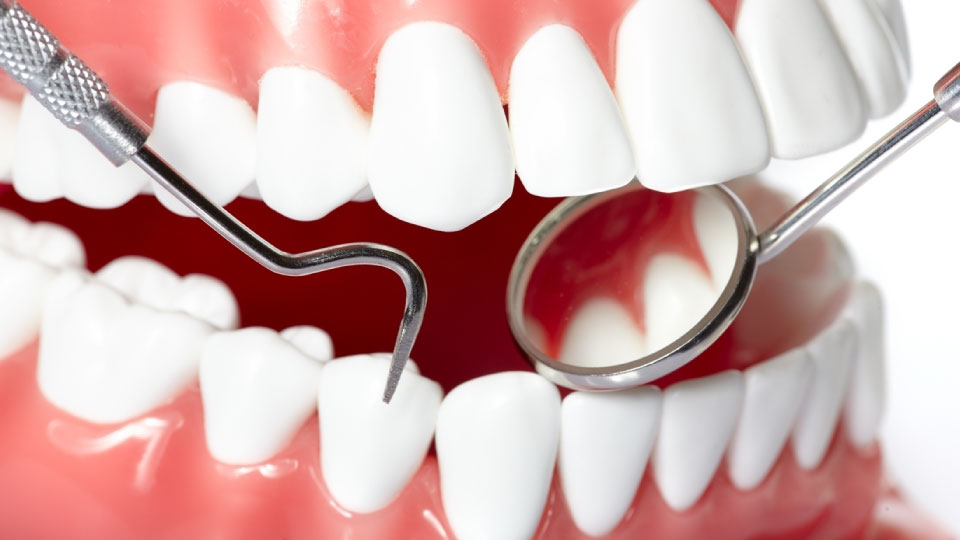 5 Reasons to Maintain Oral Hygiene