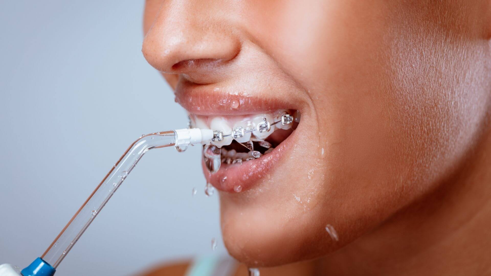 Should You Use a Water Flosser?
